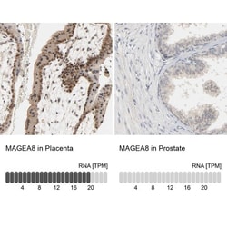 MAGEA8 Antibody, Novus Biologicals 0.1mL; Unlabeled:Antibodies, Polyclonal